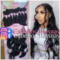 Extensión LINDSEY